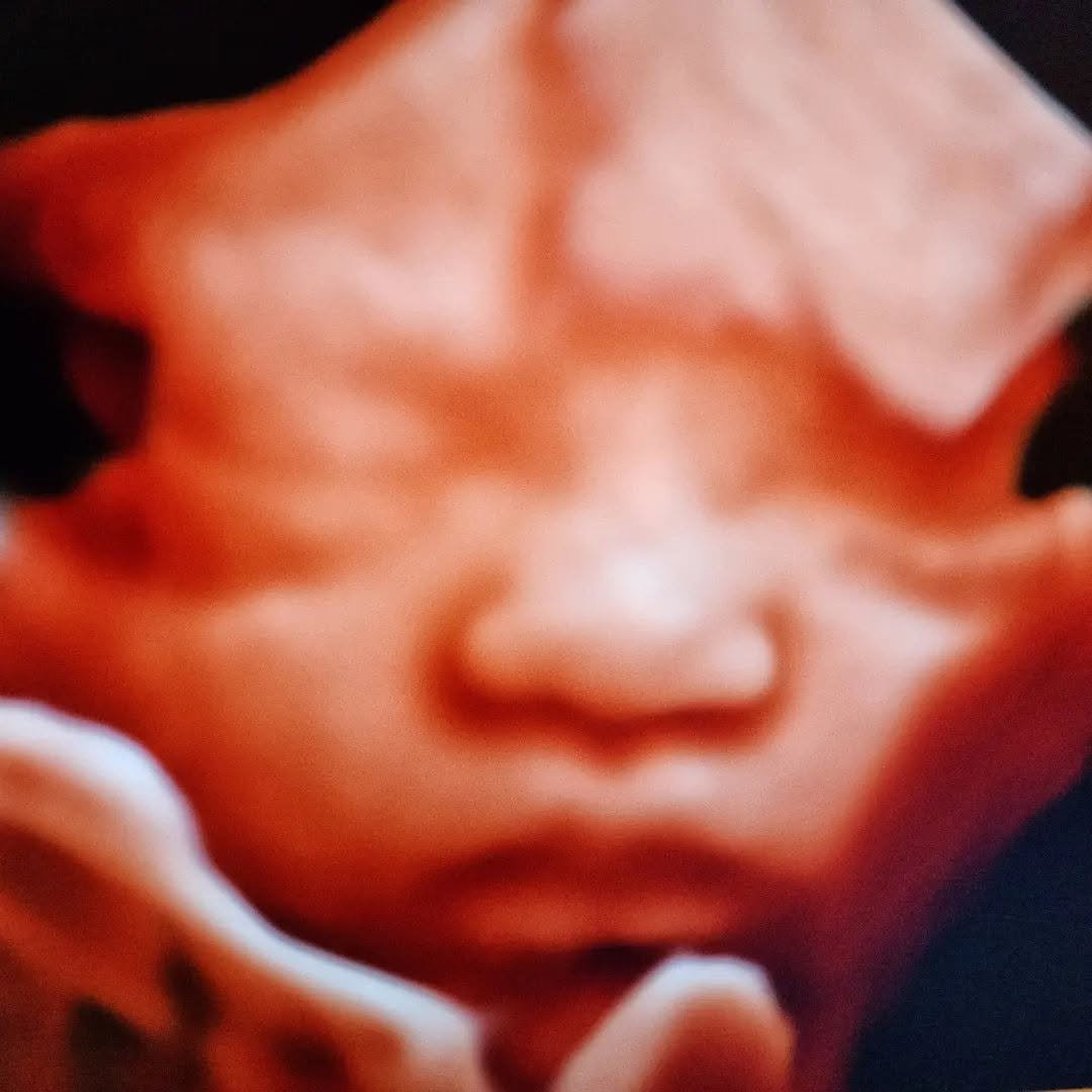 4D ultrasound of a fetal face